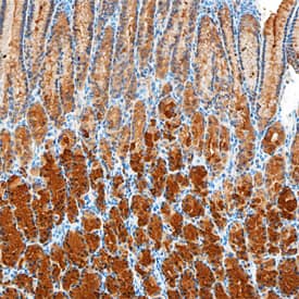 Gastrokine 1 was detected in immersion fixed paraffin-embedded sections of human stomach using Mouse Anti-Human Gastrokine 1 Monoclonal Antibody (Catalog # MAB6395) at 15 µg/mL overnight at 4 °C. Before incubation with the primary antibody, tissue was subjected to heat-induced epitope retrieval using Antigen Retrieval Reagent-Basic (Catalog # CTS013). Tissue was stained using the Anti-Mouse HRP-DAB Cell & Tissue Staining Kit (brown; Catalog # CTS002) and counterstained with hematoxylin (blue). Specific staining was localized to gastric glands. View our protocol for Chromogenic IHC Staining of Paraffin-embedded Tissue Sections.