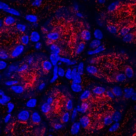 Gastrokine 1 was detected in perfusion fixed frozen sections of mouse intestine using Rat Anti-Mouse Gastrokine 1 Monoclonal Antibody (Catalog # MAB7287) at 25 µg/mL overnight at 4 °C. Tissue was stained using the NorthernLights™ 557-conjugated Anti-Rat IgG Secondary Antibody (red; Catalog # NL013) and counterstained with DAPI (blue). Specific staining was localized to gastric glands. View our protocol for Fluorescent IHC Staining of Frozen Tissue Sections.