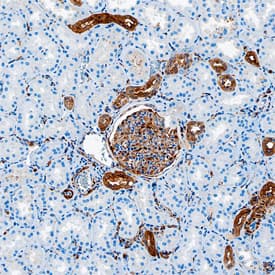 Gelsolin/GSN was detected in formalin fixed paraffin-embedded sections of human kidney using Mouse Anti-Human/Mouse/Rat Gelsolin/GSN Monoclonal Antibody (Catalog # MAB8170) at 15 µg/mL overnight at 4 °C. Tissue was stained using the Anti-Mouse HRP-DAB Cell & Tissue Staining Kit (brown; Catalog # CTS002) and counterstained with hematoxylin (blue). Specific staining was localized to glomeruli and distal convoluted tubules. View our protocol for Chromogenic IHC Staining of Paraffin-embedded Tissue Sections.