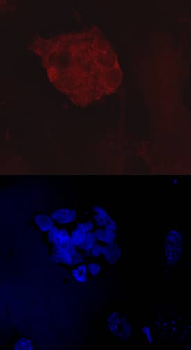 VISTA/B7-H5/PD-1H was detected in immersion fixed BG01V human embryonic stem cells using Mouse Anti-Human VISTA/B7-H5/PD-1H Monoclonal Antibody (Catalog # MAB71261) at 10 µg/mL for 3 hours at room temperature. Cells were stained using the NorthernLights™ 557-conjugated Anti-Mouse IgG Secondary Antibody (red, upper panel; Catalog # NL007) and counterstained with DAPI (blue, lower panel). Specific staining was localized to cell surfaces and cytoplasm. View our protocol for Fluorescent ICC Staining of Cells on Coverslips.