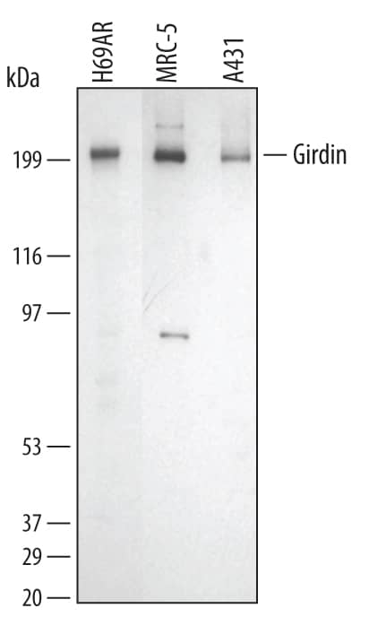Western Blot Girdin Antibody [Unconjugated]