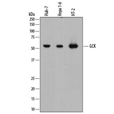 Western blot shows lysates of Huh-7 human hepatoma cell line, Hepa 1-6 mouse hepatoma cell line, and HT-2 mouse T cell line. PVDF membrane was probed with 1 µg/mL of Mouse Anti-Human Glucokinase/GCK Monoclonal Antibody (Catalog # MAB7840) followed by HRP-conjugated Anti-Mouse IgG Secondary Antibody (Catalog # HAF018). A specific band was detected for Glucokinase/GCK at approximately 52 kDa (as indicated). This experiment was conducted under reducing conditions and using Immunoblot Buffer Group 1.