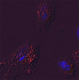 Glucosylceramidase/GBA was detected in immersion fixed HeLa human cervical epithelial carcinoma cell line using Mouse Anti-Human Glucosylceramidase/GBA Monoclonal Antibody (Catalog # MAB7410) at 15 µg/mL for 3 hours at room temperature. Cells were stained using the Northern-Lights™ 557-conjugated Anti-Mouse IgG Secondary Antibody (red; Catalog # NL007) and counterstained with DAPI (blue). Specific staining was localized to lysosomes. View our protocol for Fluorescent ICC Staining of Cells on Coverslips.