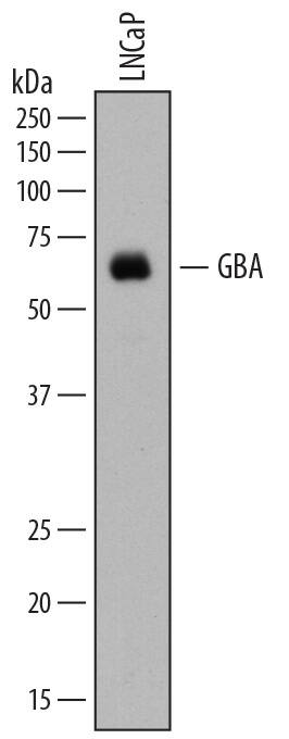 Western blot shows lysates of LNCaP human prostate cancer cell line. PVDF membrane was probed with 1 µg/mL of Mouse Anti-Human Glucosylceramidase/GBA Monoclonal Antibody (Catalog # MAB7410) followed by HRP-conjugated Anti-Mouse IgG Secondary Antibody (Catalog # HAF007). A specific band was detected for Glucosylceramidase/GBA at approximately 60 kDa (as indicated). This experiment was conducted under reducing conditions and using Immunoblot Buffer Group 1.
