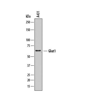 Western blot shows lysates of A431 human epithelial carcinoma cell line. PVDF membrane was probed with 2 µg/mL of Mouse Anti-Human Glut1 Monoclonal Antibody (Catalog # MAB14181) followed by HRP-conjugated Anti-Mouse IgG Secondary Antibody (Catalog # HAF007). A specific band was detected for Glut1 at approximately 60 kDa (as indicated). This experiment was conducted under reducing conditions and using Immunoblot Buffer Group 1.
