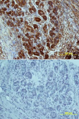 Immunohistochemistry Glut2 Antibody (199017) [Unconjugated]