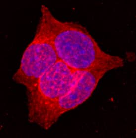 Immunocytochemistry Glut2 Antibody (205115) [Unconjugated]