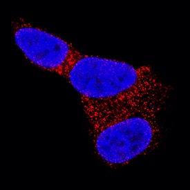 Immunocytochemistry Glut3 Antibody (202017) [Unconjugated]