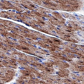Glut4 was detected in immersion fixed paraffin-embedded sections of rat heart tissue using Mouse Anti-Rat Glut4 Monoclonal Antibody (Catalog # MAB1262) at 5 µg/mL overnight at 4 °C. Before incubation with the primary antibody, tissue was subjected to heat-induced epitope retrieval using Antigen Retrieval Reagent-Basic (Catalog # CTS013). Tissue was stained using the Anti-Mouse IgG VisUCyte™ HRP Polymer Antibody (brown; Catalog # VC001) and counterstained with hematoxylin (blue). Specific staining was localized to cytoplasm in cardiomyocytes. View our protocol for IHC Staining with VisUCyte HRP Polymer Detection Reagents.