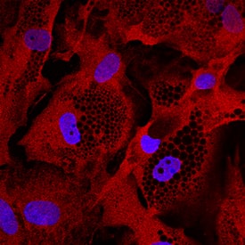 Glut4 was detected in immersion fixed human mesenchymal stem cells differentiated to adipocytes using Mouse Anti-Human Glut4 Monoclonal Antibody (Catalog # MAB8654) at 10 µg/mL for 3 hours at room temperature. Cells were stained using the NorthernLights™ 557-conjugated Anti-Mouse IgG Secondary Antibody (red; Catalog # NL007) and counterstained with DAPI (blue). Specific staining was localized to cytoplasm. View our protocol for Fluorescent ICC Staining of Stem Cells on Coverslips.