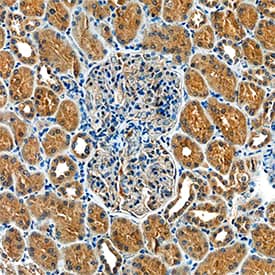 Glut4 was detected in immersion fixed paraffin-embedded sections of human kidney using Mouse Anti-Human Glut4 Monoclonal Antibody (Catalog # MAB8654) at 15 µg/mL overnight at 4 °C. Tissue was stained using the Anti-Mouse HRP-DAB Cell & Tissue Staining Kit (brown; Catalog # CTS002) and counterstained with hematoxylin (blue). Specific staining was localized to cytoplasm in tubular epithelial cells. View our protocol for Chromogenic IHC Staining of Paraffin-embedded Tissue Sections.