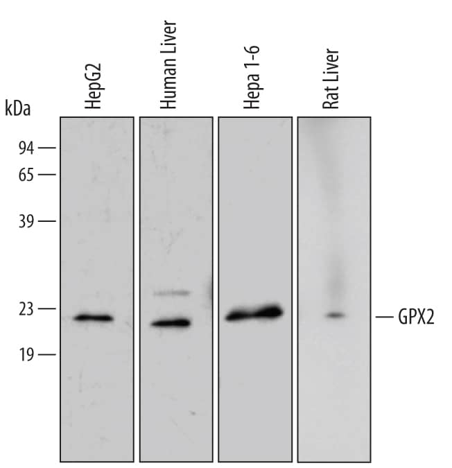 Western blot shows lysates of HepG2 human hepatocellular carcinoma cell line, human liver tissue, Hepa 1-6 mouse hepatoma cell line, and rat liver tissue. PVDF membrane was probed with 1 µg/mL of Human/Mouse/Rat Glutathione Peroxidase 2 Monoclonal Antibody (Catalog # MAB5470) followed by HRP-conjugated Anti-Mouse IgG Secondary Antibody (Catalog # HAF007). A specific band was detected for Glutathione Peroxidase 2 at approximately 22 kDa (as indicated). This experiment was conducted under reducing conditions and using Immunoblot Buffer Group 2.