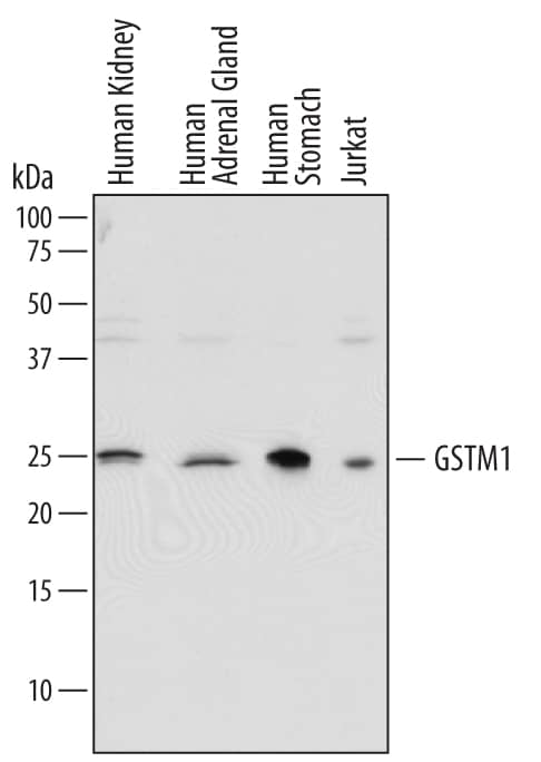 Western blot shows lysates of human kidney tissue, human adrenal gland tissue, human stomach tissue, and Jurkat human acute T cell leukemia cell line. PVDF membrane was probed with 0.2 µg/mL of Sheep Anti-Human Glutathione S-Transferase mu 1/GS Antigen Affinity-purified Polyclonal Antibody (Catalog # AF6894) followed by HRP-conjugated Anti-Sheep IgG Secondary Antibody (Catalog # HAF016). A specific band was detected for Glutathione S-Transferase mu 1/GS at approximately 25 kDa (as indicated). This experiment was conducted under reducing conditions and using Immunoblot Buffer Group 1.