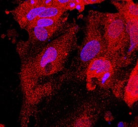Glutathione S-Transferase pi 1/GSTP1 was detected in immersion fixed BG01V human embryonic stem cells differentiated into hepatocytes using Mouse Anti-Human Glutathione S-Transferase pi 1/GSTP1 Monoclonal Antibody (Catalog # MAB6455) at 10 µg/mL for 3 hours at room temperature. Cells were stained using the NorthernLights™ 557-conjugated Anti-Mouse IgG Secondary Antibody (red; Catalog # NL007) and counterstained with DAPI (blue). Specific staining was localized to cytoplasm. View our protocol for Fluorescent ICC Staining of Stem Cells on Coverslips.