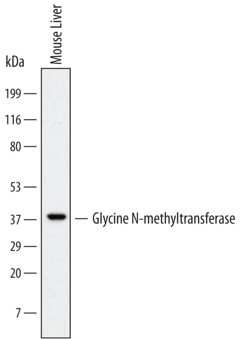 Western blot shows lysates of mouse liver tissue. PVDF Membrane was probed with 1 µg/mL of Human Glycine N-methyltransferase/GNMT Monoclonal Antibody (Catalog # MAB6526) followed by HRP-conjugated Anti-Mouse IgG Secondary Antibody (Catalog # HAF007). A specific band was detected for Glycine N-methyltransferase/GNMT at approximately 37 kDa (as indicated). This experiment was conducted under reducing conditions and using Immunoblot Buffer Group 1.