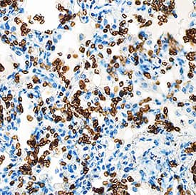 Immunohistochemistry Glycophorin A Antibody (R10) [Unconjugated]