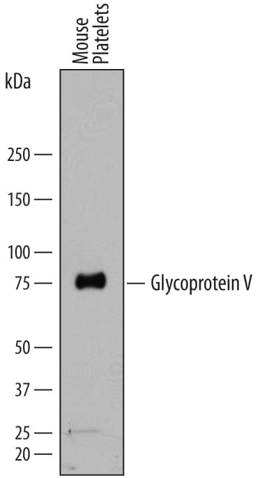 Western Blot Glycoprotein V/CD42d Antibody