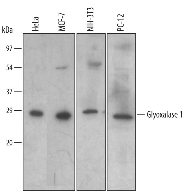 Western Blot Glyoxalase I Antibody [Unconjugated]