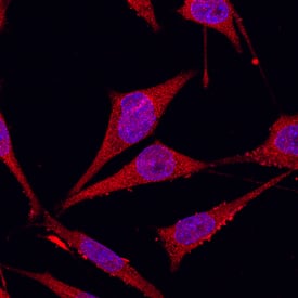 Immunocytochemistry Glypican 1 Antibody [Unconjugated]