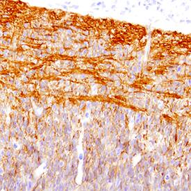 Glypican 2 was detected in perfusion fixed frozen sections of mouse embryo (15 d.p.c.) using Goat Anti-Mouse Glypican 2 Biotinylated Antigen Affinity-purified Polyclonal Antibody (Catalog # BAF2355) at 0.3 µg/mL overnight at 4 °C. Tissue was stained using the Anti-Goat HRP-DAB Cell & Tissue Staining Kit (brown; Catalog # CTS008) and counterstained with hematoxylin (blue). Specific staining was localized to processes in developing brain. View our protocol for Chromogenic IHC Staining of Frozen Tissue Sections.