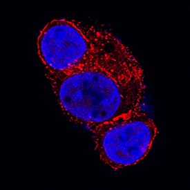 Glypican 3 was detected in immersion fixed HepG2 human hepatocellular carcinoma cell line using Sheep Anti-Human Glypican 3 Antigen Affinity-purified Polyclonal Antibody (Catalog # AF2119) at 1.7 µg/mL for 3 hours at room temperature. Cells were stained using the NorthernLights™ 557-conjugated Anti-Sheep IgG Secondary Antibody (red; Catalog # NL010) and counterstained with DAPI (blue). Specific staining was localized to cytoplasm and cell membranes. View our protocol for Fluorescent ICC Staining of Cells on Coverslips.