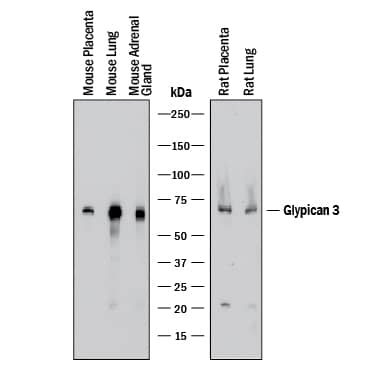Western blot shows lysates of mouse placenta tissue, mouse lung tissue, mouse adrenal gland tissue, rat placenta tissue, and rat lung tissue. PVDF membrane was probed with 1 µg/mL of Mouse Anti-Human Glypican 3 Monoclonal Antibody (Catalog # MAB2119) followed by HRP-conjugated Anti-Mouse IgG Secondary Antibody (Catalog # HAF018). A specific band was detected for Glypican 3 at approximately 65-70 kDa (as indicated). This experiment was conducted under reducing conditions and using Immunoblot Buffer Group 1.