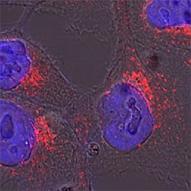 Golgi Glycoprotein 1/GLG1 was detected in immersion fixed HeLa human cervical epithelial carcinoma cell line using Mouse Anti-Human/Mouse Golgi Glycoprotein 1/GLG1 Monoclonal Antibody (Catalog # MAB78791) at 25 µg/mL for 3 hours at room temperature. Cells were stained using the NorthernLights™ 557-conjugated Anti-Mouse IgG Secondary Antibody (red; Catalog # NL007) and counterstained with DAPI (blue). Specific staining was localized to cytoplasm. View our protocol for Fluorescent ICC Staining of Cells on Coverslips.