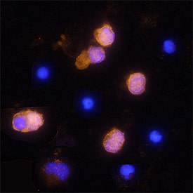 Immunocytochemistry Granzyme A Antibody [Unconjugated]