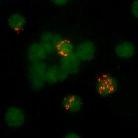 Immunocytochemistry Granzyme A Antibody (356412)