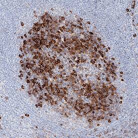 Immunohistochemistry Granzyme K Antibody (2471A) [Unconjugated]