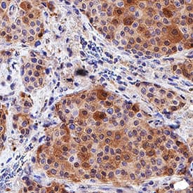 Immunohistochemistry Gremlin 1 Antibody [Unconjugated]