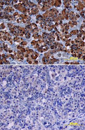 Growth Hormone was detected in immersion fixed paraffin-embedded sections of human pituitary using Goat Anti-Human/Mouse/Rat Growth Hormone Antigen Affinity-purified Polyclonal Antibody (Catalog # AF1067) at 10 µg/mL overnight at 4 °C. Tissue was stained using the Anti-Goat HRP-DAB Cell & Tissue Staining Kit (brown; Catalog # CTS008) and counterstained with hematoxylin (blue). Lower panel shows a lack of labeling if primary antibodies are omitted and tissue is stained only with secondary antibody followed by incubation with detection reagents. View our protocol for Chromogenic IHC Staining of Paraffin-embedded Tissue Sections.