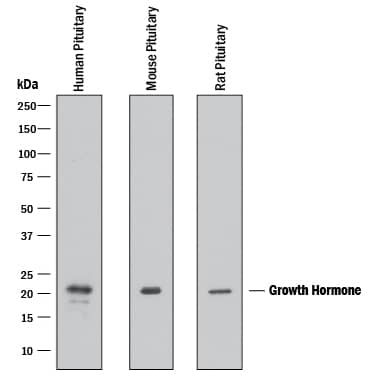 Western Blot Growth Hormone Antibody [Unconjugated]