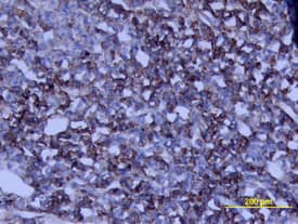 Growth Hormone was detected in perfusion fixed frozen sections of rat pituitary using Goat Anti-Rat Growth Hormone Antigen Affinity-purified Polyclonal Antibody (Catalog # AF1566) at 15 µg/mL overnight at 4 °C. Tissue was stained using the Anti-Goat HRP-DAB Cell & Tissue Staining Kit (brown; Catalog # CTS008) and counterstained with hematoxylin (blue). View our protocol for Chromogenic IHC Staining of Frozen Tissue Sections.