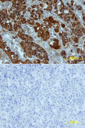 Growth Hormone was detected in immersion fixed paraffin-embedded sections of human pituitary using Goat Anti-Human Growth Hormone Biotinylated Antigen Affinity-purified Polyclonal Antibody (Catalog # BAF1067) at 10 µg/mL overnight at 4 °C. Tissue was stained using the Anti-Goat HRP-DAB Cell & Tissue Staining Kit (brown; Catalog # CTS008) and counterstained with hematoxylin (blue). Lower panel shows a lack of labeling if primary antibodies are omitted and tissue is stained only with secondary antibody followed by incubation with detection reagents. View our protocol for Chromogenic IHC Staining of Paraffin-embedded Tissue Sections.