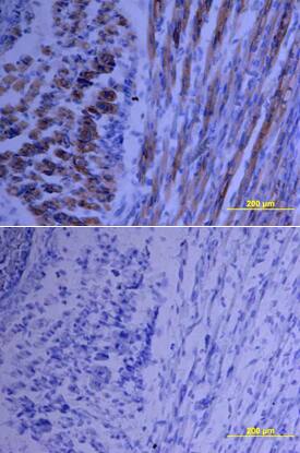 Growth Hormone was detected in immersion fixed frozen sections of mouse embryo using Goat Anti-Rat Growth Hormone Biotinylated Antigen Affinity-purified Polyclonal Antibody (Catalog # BAF1566) at 15 µg/mL overnight at 4 °C. Tissue was stained using the Anti-Goat HRP-DAB Cell & Tissue Staining Kit (brown; Catalog # CTS008) and counterstained with hematoxylin (blue). Lower panel shows a lack of labeling if primary antibodies are omitted and tissue is stained only with secondary antibody followed by incubation with detection reagents. View our protocol for Chromogenic IHC Staining of Frozen Tissue Sections.