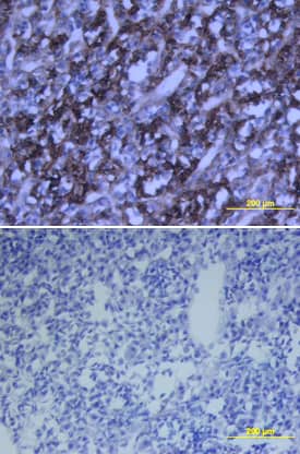 Growth Hormone was detected in perfusion fixed frozen sections of rat pituitary using Goat Anti-Rat Growth Hormone Biotinylated Antigen Affinity-purified Polyclonal Antibody (Catalog # BAF1566) at 15 µg/mL overnight at 4 °C. Tissue was stained using the Anti-Goat HRP-DAB Cell & Tissue Staining Kit (brown; Catalog # CTS008) and counterstained with hematoxylin (blue). Lower panel shows a lack of labeling if primary antibodies are omitted and tissue is stained only with secondary antibody followed by incubation with detection reagents. View our protocol for Chromogenic IHC Staining of Frozen Tissue Sections.