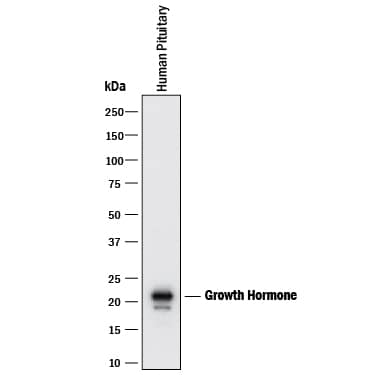 Western blot shows lysates of human pituitary gland tissue. PVDF membrane was probed with 2 µg/mL of Mouse Anti-Human Growth Hormone Monoclonal Antibody (Catalog # MAB1067) followed by HRP-conjugated Anti-Mouse IgG Secondary Antibody (Catalog # HAF018). A specific band was detected for Growth Hormone at approximately 22 kDa (as indicated). This experiment was conducted under reducing conditions and using Immunoblot Buffer Group 1.