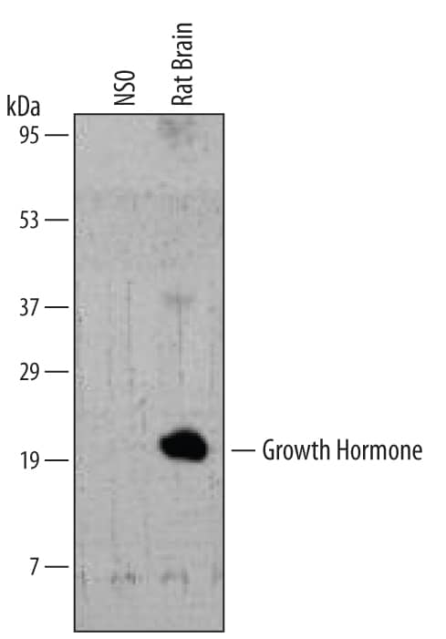 Western blot shows lysates of rat brain tissue. PVDF membrane was probed with 2 µg/mL of Rat Growth Hormone Monoclonal Antibody (Catalog # MAB1566) followed by HRP-conjugated Anti-Mouse IgG Secondary Antibody (Catalog # HAF007). A specific band was detected for Growth Hormone at approximately 20 kDa (as indicated). This experiment was conducted under reducing conditions and using Immunoblot Buffer Group 2.