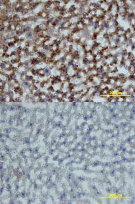 Immunohistochemistry Growth Hormone R Antibody