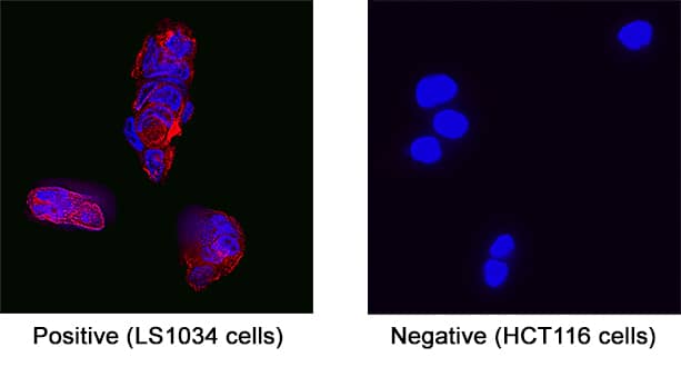 Immunocytochemistry GUCY2C Antibody (2543C) [Unconjugated]