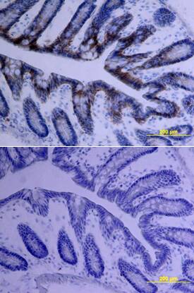 HAI-1 was detected in perfusion fixed frozen sections of mouse intestine using Goat Anti-Mouse HAI-1 Biotinylated Antigen Affinity-purified Polyclonal Antibody (Catalog # BAF1141) at 15 µg/mL overnight at 4 °C. Tissue was stained using the Anti-Goat HRP-DAB Cell & Tissue Staining Kit (brown; Catalog # CTS008) and counterstained with hematoxylin (blue). Lower panel shows a lack of labeling if primary antibodies are omitted and tissue is stained only with secondary antibody followed by incubation with detection reagents. View our protocol for Chromogenic IHC Staining of Frozen Tissue Sections.
