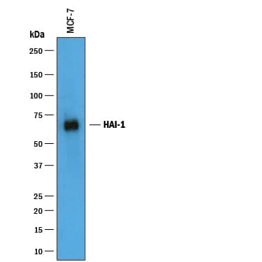Western Blot HAI-1/HGFA Inhibitor 1 Antibody [Unconjugated]