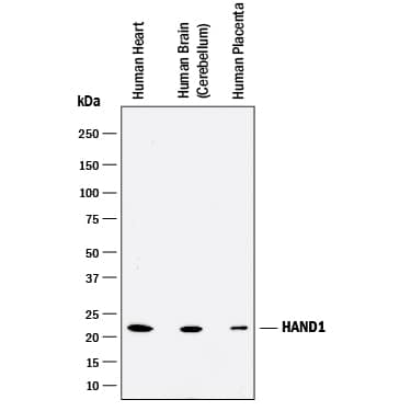 Western Blot HAND1 Antibody [Unconjugated]