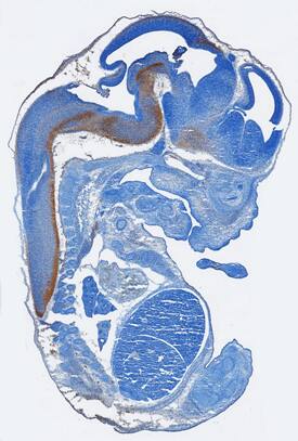 HB-EGF was detected in immersion fixed frozen sections of mouse embryo (15 d.p.c.) using Sheep Anti-Mouse HB-EGF Antigen Affinity-purified Polyclonal Antibody (Catalog # AF8239) at 15 µg/mL overnight at 4 °C. Tissue was stained using the Anti-Sheep HRP-DAB Cell & Tissue Staining Kit (brown; Catalog # CTS019) and counterstained with hematoxylin (blue). Specific staining was localized to developing central nervous system. View our protocol for Chromogenic IHC Staining of Frozen Tissue Sections.
