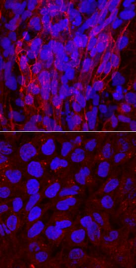 HCN4 was detected in immersion fixed BG01V human embryonic stem cells, undifferentiated (lower panel) and differentiated into cardiomyocytes (upper panel), using Sheep Anti-Human HCN4 Antigen Affinity-purified Polyclonal Antibody (Catalog # AF8138) at 10 µg/mL for 3 hours at room temperature. Cells were stained using the NorthernLights™ 557-conjugated Anti-Sheep IgG Secondary Antibody (red; Catalog # NL010) and counterstained with DAPI (blue). Specific staining was localized to cell surfaces. View our protocol for Fluorescent ICC Staining of Stem Cells on Coverslips.