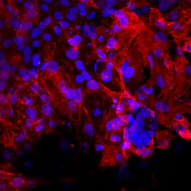 HCN4 was detected in immersion fixed BG01V human embryonic stem cells differentiated to cardiac cells using Mouse Anti-Human HCN4 Monoclonal Antibody (Catalog # MAB8138) at 10 µg/mL for 3 hours at room temperature. Cells were stained using the NorthernLights™ 557-conjugated Anti-Mouse IgG Secondary Antibody (red; Catalog # NL007) and counterstained with DAPI (blue). Specific staining was localized to cell surfaces. View our protocol for Fluorescent ICC Staining of Stem Cells on Coverslips.