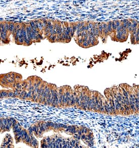 HE4/WFDC2 was detected in immersion fixed paraffin-embedded sections of human ovary using Mouse Anti-Human HE4/WFDC2 Monoclonal Antibody (Catalog # MAB6274) at 15 µg/mL overnight at 4 °C. Before incubation with the primary antibody, tissue was subjected to heat-induced epitope retrieval using Antigen Retrieval Reagent-Basic (Catalog # CTS013). Tissue was stained using the Anti-Mouse HRP-DAB Cell & Tissue Staining Kit (brown; Catalog # CTS002) and counterstained with hematoxylin (blue). Specific staining was localized to the cytoplasm of epithelial cells. View our protocol for Chromogenic IHC Staining of Paraffin-embedded Tissue Sections.