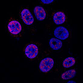 HES-1 was detected in immersion fixed MCF-7 human breast cancer cell line using Mouse Anti-Human HES-1 Monoclonal Antibody (Catalog # MAB3317) at 8 µg/mL for 3 hours at room temperature. Cells were stained using the NorthernLights™ 557-conjugated Anti-Mouse IgG Secondary Antibody (red; Catalog # NL007) and counterstained with DAPI (blue). Specific staining was localized to nuclei. View our protocol for Fluorescent ICC Staining of Cells on Coverslips.
