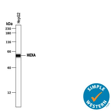 Simple Western Hexosaminidase A/HEXA Antibody [Unconjugated]